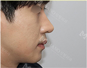 눈 슬라이드 이미지