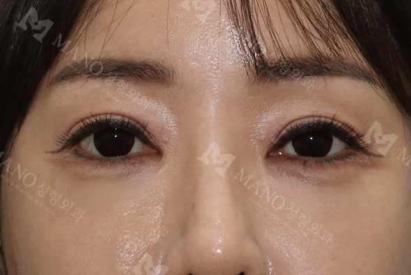 눈 슬라이드 이미지