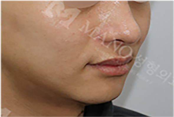 눈 슬라이드 이미지